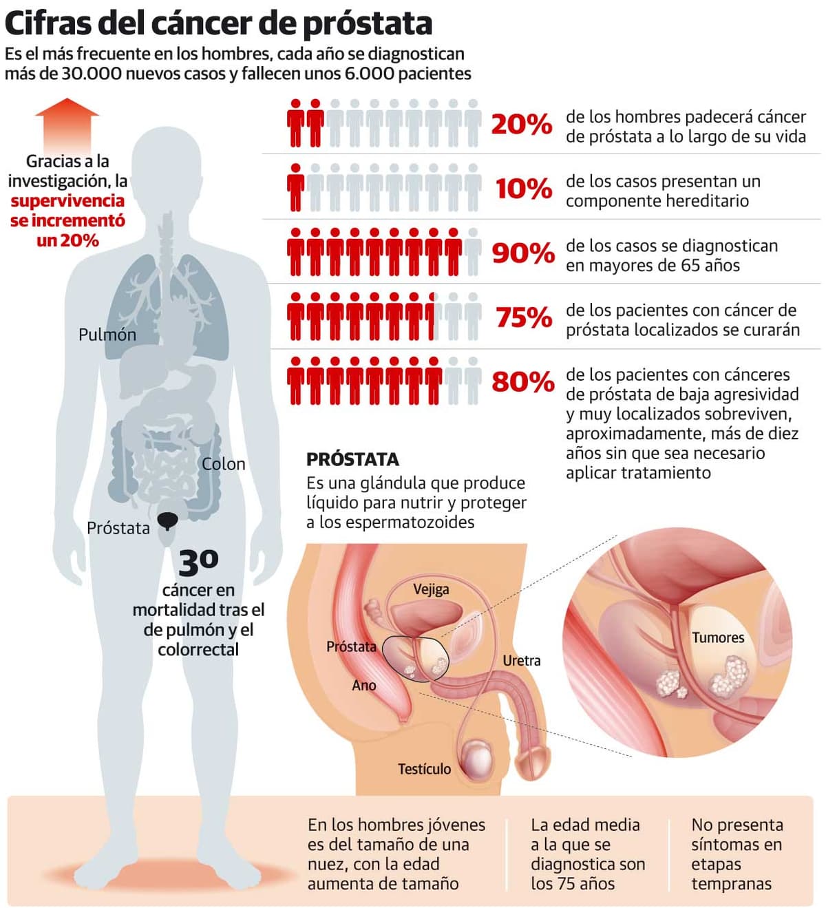 Por qué el pronóstico para los pacientes con cáncer de próstata nunca ha sido tan positivo
